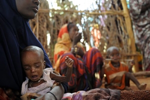 索馬里一名流離失所的母親將饑餓的孩子抱在懷中，在食物中心等待食物。（圖：法新社） <br/>